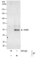 SS18 Antibody in Immunoprecipitation (IP)