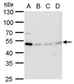TIPIN Polyclonal Antibody