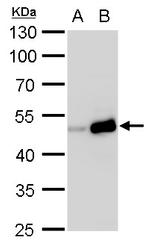 TIPIN Antibody in Western Blot (WB)