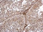 TRAPPC2L Antibody in Immunohistochemistry (Paraffin) (IHC (P))