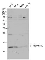 TRAPPC2L Antibody in Western Blot (WB)