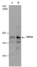 TRPS1 Antibody in Western Blot (WB)