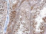 WDR44 Antibody in Immunohistochemistry (Paraffin) (IHC (P))