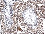 GPN1 Antibody in Immunohistochemistry (Paraffin) (IHC (P))