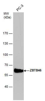 ZBTB46 Polyclonal Antibody