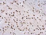 ZFP82 Antibody in Immunohistochemistry (Paraffin) (IHC (P))