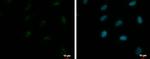 ZNF556 Polyclonal Antibody