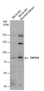 ZNF624 Antibody in Western Blot (WB)