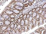 ZNF691 Antibody in Immunohistochemistry (Paraffin) (IHC (P))