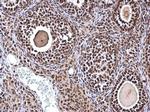 ZNF691 Antibody in Immunohistochemistry (Paraffin) (IHC (P))