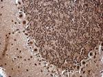 ZNF691 Antibody in Immunohistochemistry (Paraffin) (IHC (P))