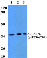 Phospho-Aurora B/C (Thr236, Thr202) Polyclonal Antibody