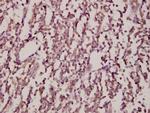 JNK1/JNK2/JNK3 Polyclonal Antibody