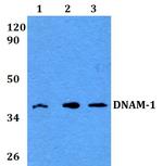 CD226 Polyclonal Antibody