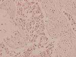 AMPK alpha-1,2 Polyclonal Antibody