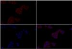 alpha Catenin Polyclonal Antibody