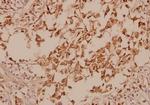 GAD67 Polyclonal Antibody