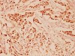 NRG1 Polyclonal Antibody