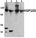 HSP105 Antibody in Western Blot (WB)