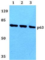 p63 Antibody in Western Blot (WB)