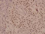 KV3.2 (KCNC2) Polyclonal Antibody