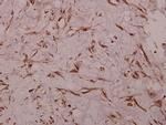 Sodium Channel Pan Antibody in Immunohistochemistry (Paraffin) (IHC (P))