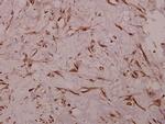Sodium Channel Pan Polyclonal Antibody