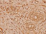 Cystatin B Antibody in Immunohistochemistry (Paraffin) (IHC (P))