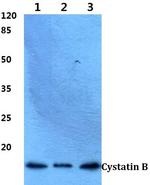 Cystatin B Antibody in Western Blot (WB)