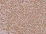 HYD Polyclonal Antibody