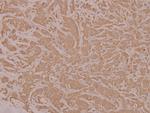 HYD Antibody in Immunohistochemistry (Paraffin) (IHC (P))