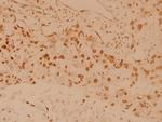 MSK1 Antibody in Immunohistochemistry (Paraffin) (IHC (P))