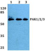 PAK1/2/3 Antibody in Western Blot (WB)