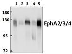EphA2/EphA3/EphA4 Polyclonal Antibody