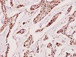 H1FOO Polyclonal Antibody