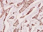 H1FOO Antibody in Immunohistochemistry (Paraffin) (IHC (P))