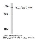 PDPK1/PDPK2/PDPK3 Polyclonal Antibody