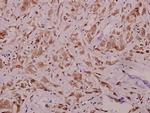 RyR2 Antibody in Immunohistochemistry (Paraffin) (IHC (P))