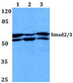 SMAD2/SMAD3 Antibody in Western Blot (WB)