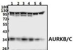 Aurora B/C Polyclonal Antibody