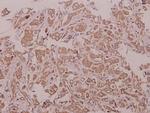 LZK Polyclonal Antibody