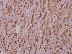 AKAP10 Antibody in Immunohistochemistry (Paraffin) (IHC (P))