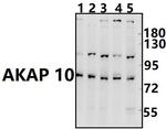 AKAP10 Antibody in Western Blot (WB)