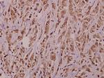 AKAP10 Antibody in Immunohistochemistry (Paraffin) (IHC (P))