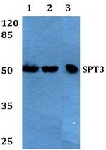 SPT3 Polyclonal Antibody