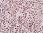 ZRANB2 Antibody in Immunohistochemistry (Paraffin) (IHC (P))