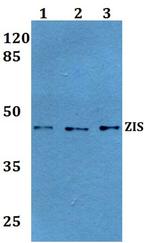 ZRANB2 Antibody in Western Blot (WB)