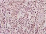 ZRANB2 Polyclonal Antibody