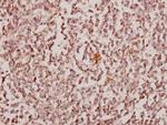 CBX6 Antibody in Immunohistochemistry (Paraffin) (IHC (P))
