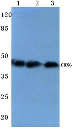 CBX6 Antibody in Western Blot (WB)